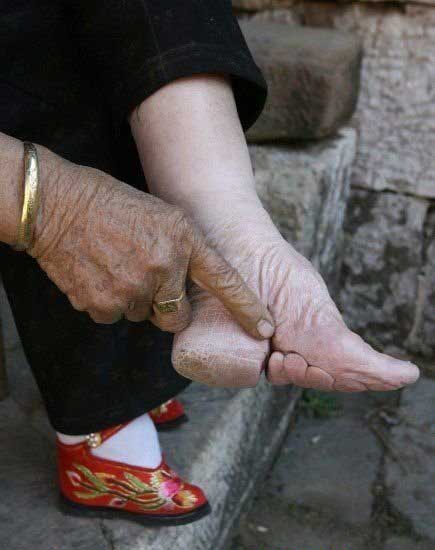 Bound Feet Women of Liuyi Village in Tonghai County
