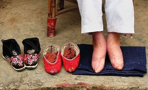 Bound Feet Women of Liuyi Village in Tonghai County